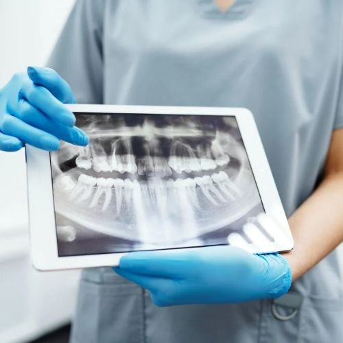 Benefits of Advanced Dental Care where a dentist show x-ray